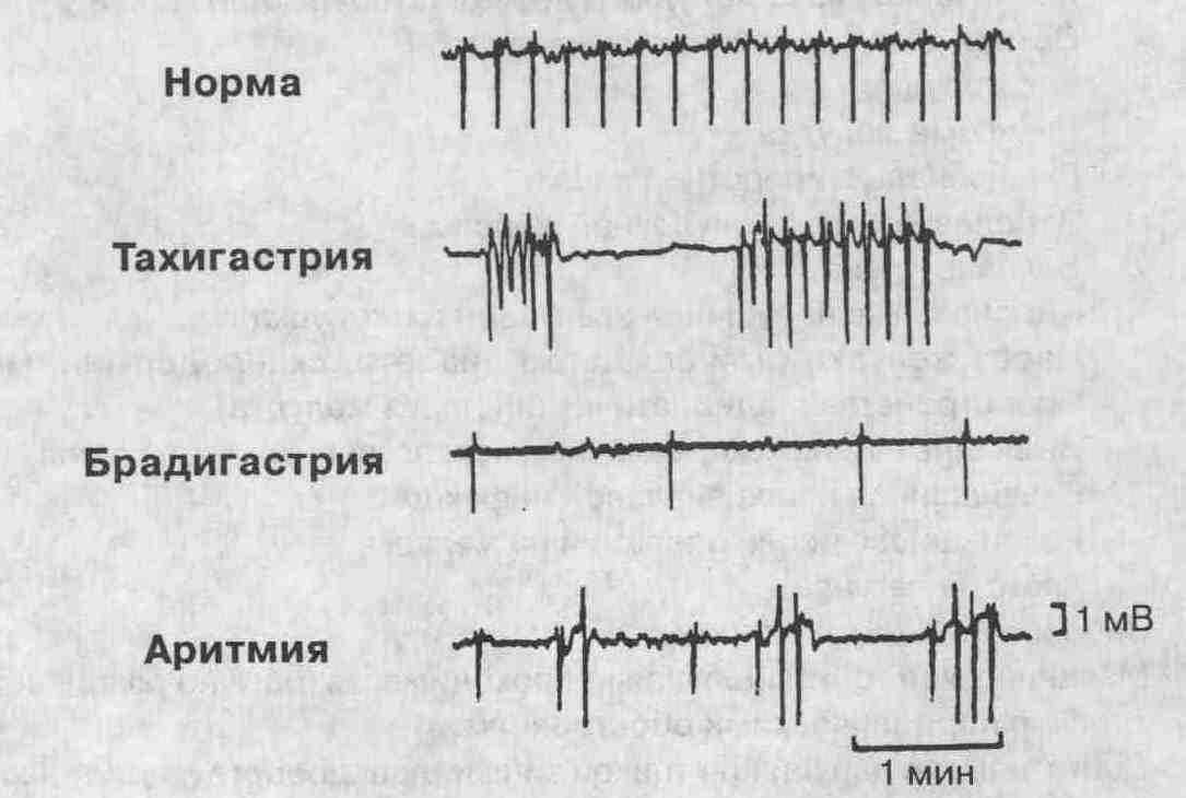 014-1.jpg