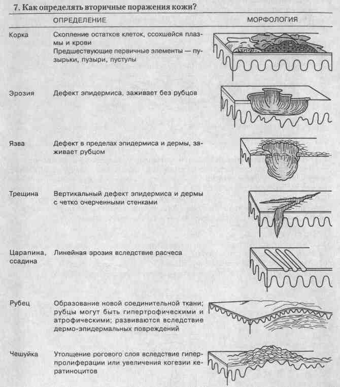 tmp3362-5.jpg